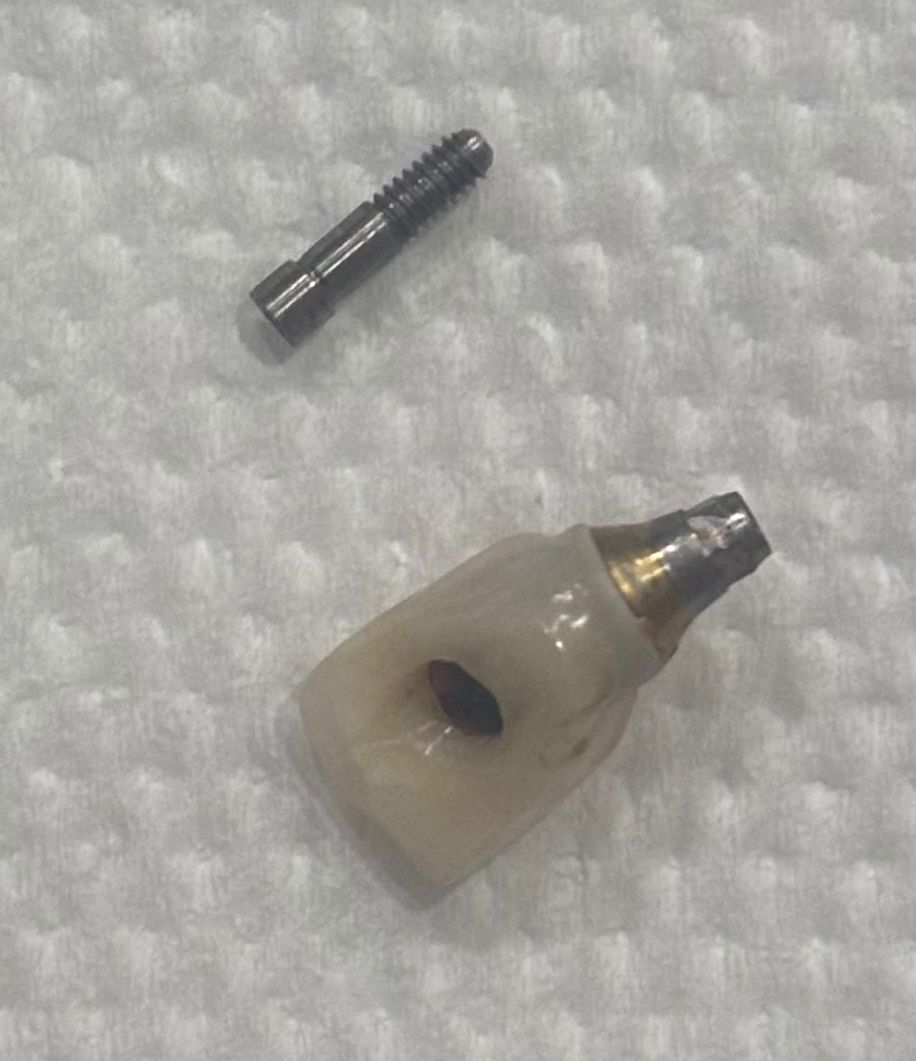 Implant Screw and Tooth Structure