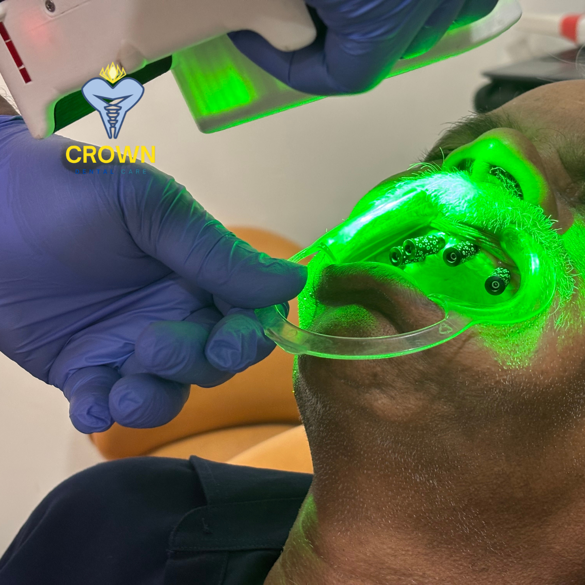 Tupel 3D Photogrammetry Scanning at Crown Dental Care