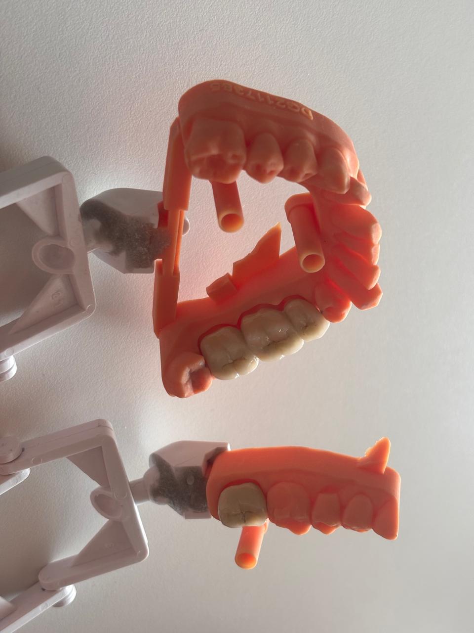 Denture Planning Model